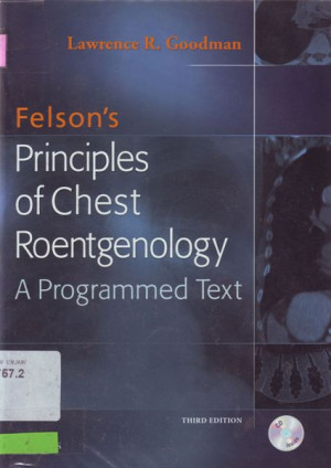 Principles of Chest Roentgenology : A Programmed Text